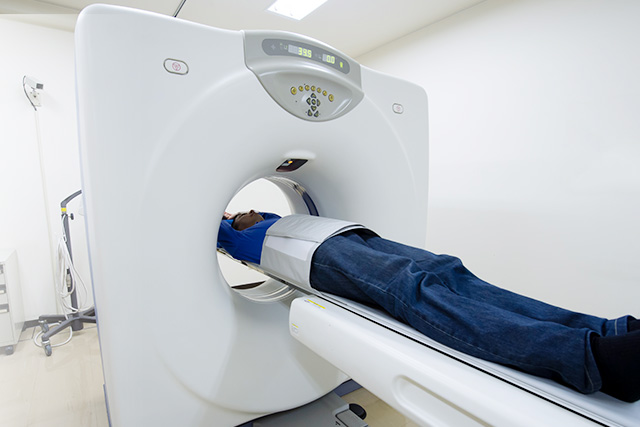 初期の肺がんであれば治癒する可能性が高いことから、小さな病変の発見に役立つ胸部CT検査の活用を