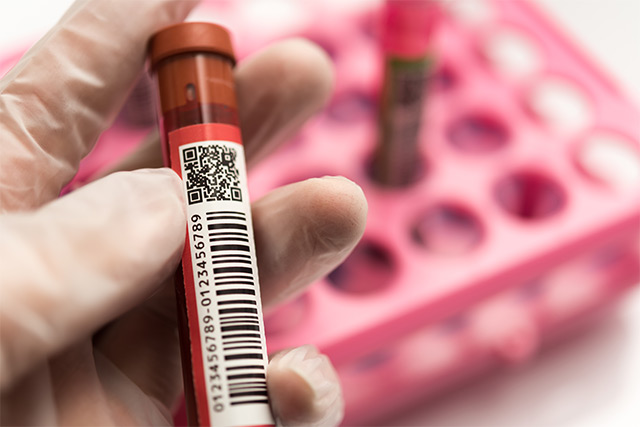 前立腺がんの検査を受ける必要があるのは誰ですか?