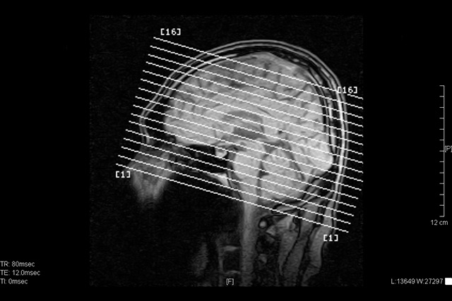 MRI（Magnetic Resonance Imaging）とは細胞組織の動きを把握する画像撮影検査のこと