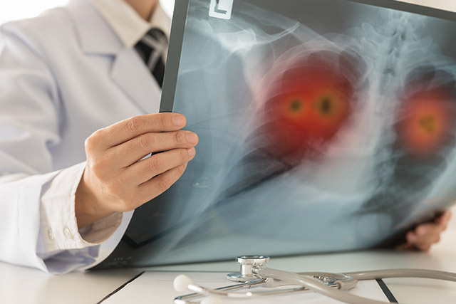 COPDかどうかをどのように判断すればよいですか?