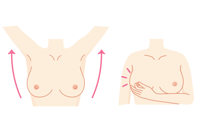 乳がんのセルフチェック1：鏡の前で左右の乳房を見る。乳頭（乳首）を軽くつまんで乳頭分泌物がないかも確認を。